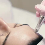 Découvrez les Bienfaits du Micronedling Casablanca chez Senteurs de Jasmin