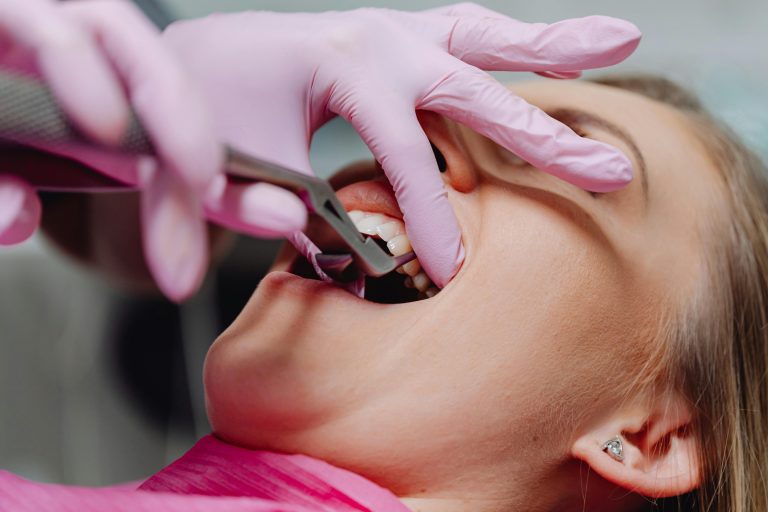 Amalgam Free Dentistry for Safer, Healthier Smiles